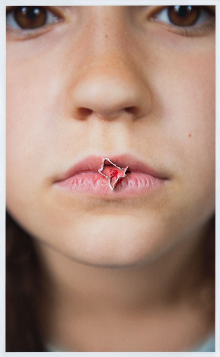 Anne Laure Autin 6 Torn